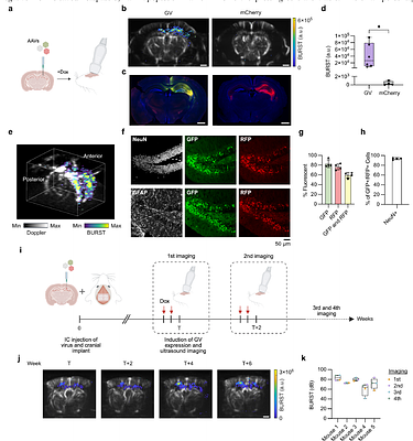 Ultrasound imaging of in situ transcriptional activity in opaque tissue
