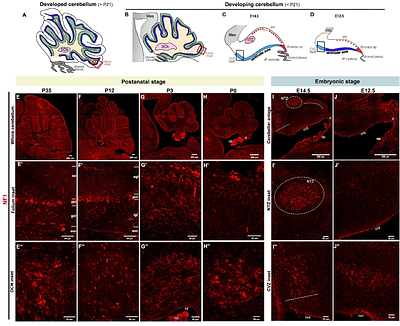 Comprehensive mapping of Neurofibromin 1 (NF1) expression in developing mouse brain