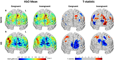 High-Density Multi-Distance fNIRS Enhances Detection of Brain Activity during a Word-Color Stroop Task