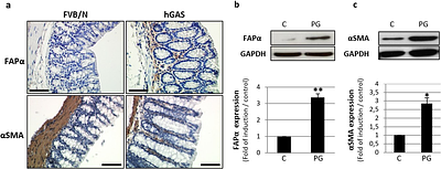 Progastrin activates colonic fibroblasts and induces a paracrine pro-migratory program in colorectal cancer cells