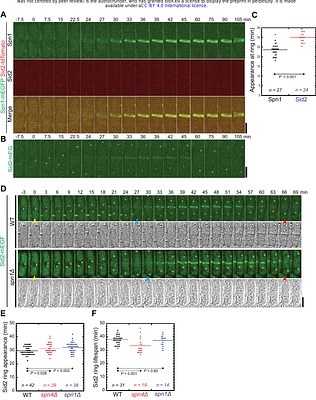 Localizations and functions of septins are susceptible to epitope tagging