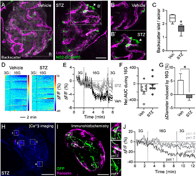 Microvascular homeostasis is compromised in pancreatic islets in a mouse model of beta cell loss and low-grade inflammation