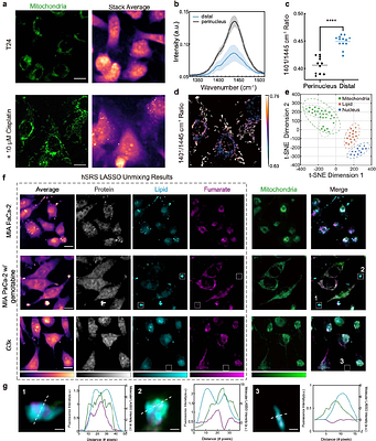 SPEND-hSRS imaging of fumarate uncovers mitochondrial metabolic heterogeneity