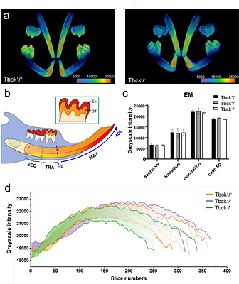 Unique mineralization pattern revealed in TBCK syndrome mouse model