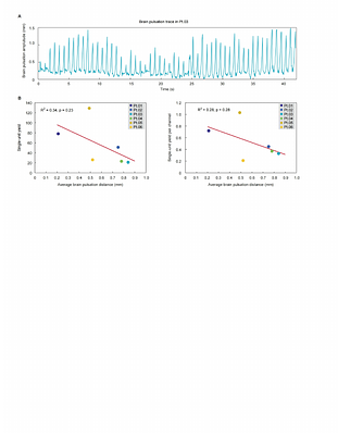 Large-scale single-neuron recording using the uFINE array in human cortex