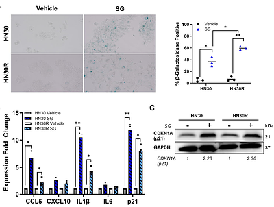 Sacituzumab Govitecan as an Effective Strategy for Sensitizing Chemoresistant HNSCC Cells to Senolytic Intervention