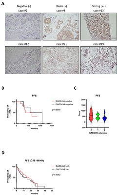 Association of GADD45A and favorable outcome in hormone positive breast cancer