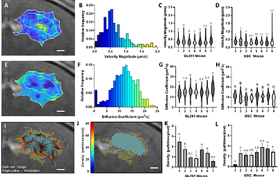 Interstitial fluid transport dynamics predict glioblastoma invasion and progression