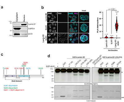 Mitotic phosphorylation of Lamin B1 rod domain by ULK1 and Aurora A/PLK1 promotes spindle function.