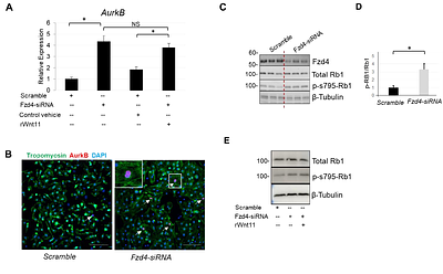 Wnt11 Positively Regulates Neonatal Cardiomyocyte Maturation at the Interphase of Life via Frizzled 4 Receptor