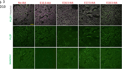 AID-mediated protein knockdown reveals the requirement of NANOS2 in prenatal gonocytes for establishing functional spermatogonial stem cells