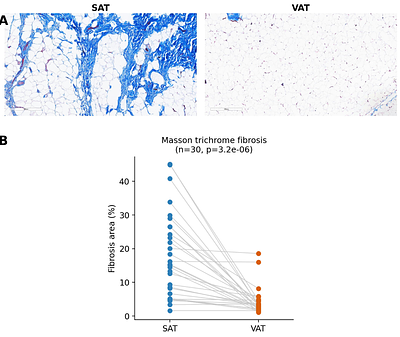 Complementary remodeling strategies distinguish human subcutaneous and omental adipose tissue