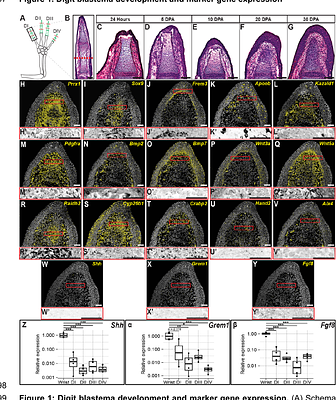 A Characterization of Axolotl Digit Regeneration: Conserved Mechanisms, Divergent Patterning, and a Critical Role for Hedgehog Signaling