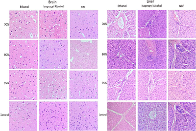 STREAMLINING HISTOPATHOLOGY: INSTAPRESERVE TISSUESAFE A SINGLE-STEP FIXATIVE THAT IMPROVES TISSUE QUALITY AND WORKFLOW EFFICIENCY