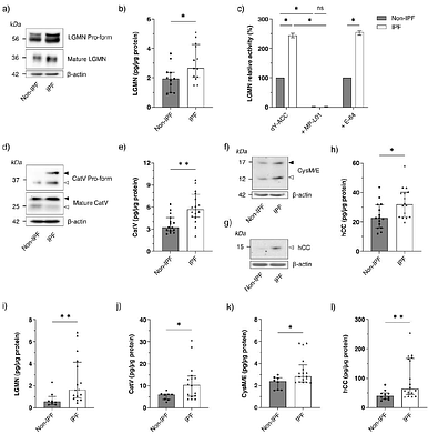 Legumain (asparaginyl endopeptidase) modulates extracellular matrix dynamics in pulmonary fibrosis
