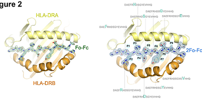 Structural presentation of amyloid β by HLA