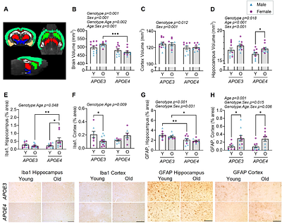 APOE4 genotype and old age interact to impact cerebrovascular function, brain volume, and neuroinflammation in mice