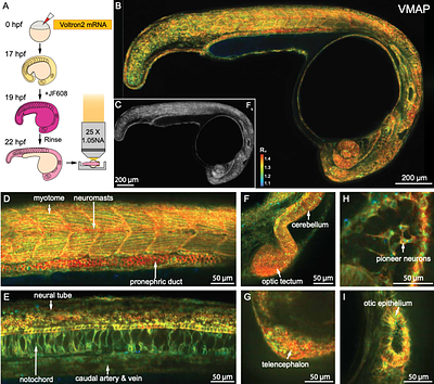Mapping absolute membrane voltage using dynamic photocycle control