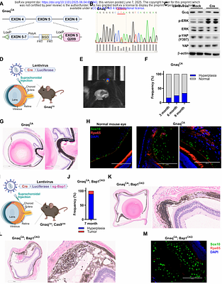 A multi-step immune-competent genetic mouse model reveals phenotypic plasticity in uveal melanoma
