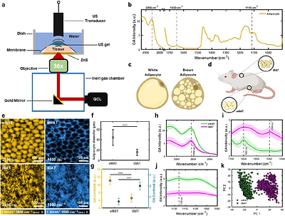 Single-cell metabolic imaging and digital scoring of fat tissue remodeling by label-free metabolic imaging