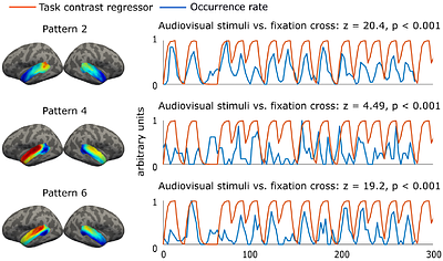 Function of the auditory cortex characterized by its intrinsic dynamic coactivation patterns estimated in individuals