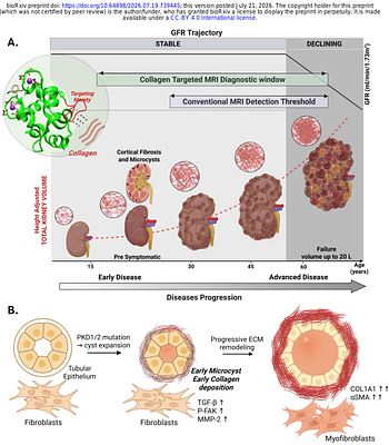 Unmasking Early Renal Fibrosis in Polycystic Kidney Disease Using Noninvasive Precision Molecular MRI of Collagen