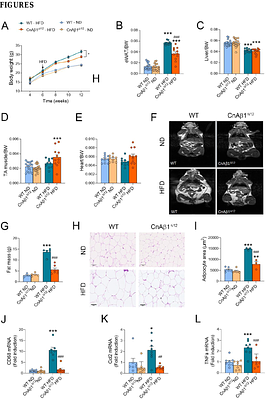 Loss of the alternative calcineurin variant CnAβ1 enhances brown adipocyte differentiation and drives metabolic overactivation through FoxO1 activation