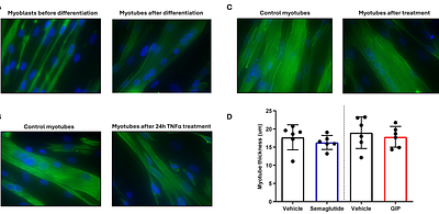 GLP-1 and GIP receptor agonism does not directly drive skeletal muscle atrophy or impair myogenesis in primary human myotubes