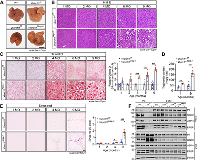 The vitamin K oxidoreductase VKORC1L1 prevents oxidative stress in hepatocytes and protects from MASLD and hepatocellular carcinoma
