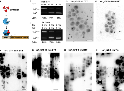 In-cell structural insights into fungal ER stress responses