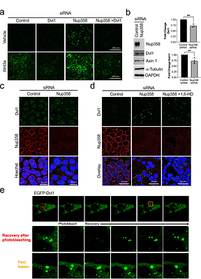 Nup358 Sustains Intestinal Epithelial Homeostasis by Preventing Dvl1 Condensate Formation to Restrain Wnt Signaling