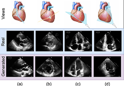 Synthetic Echocardiograms Generation Using Diffusion Models