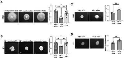 Nuclear translocation of phosphorylated YB-1 via small extracellular vesicles contributes to the malignant phenotype of triple negative breast cancer
