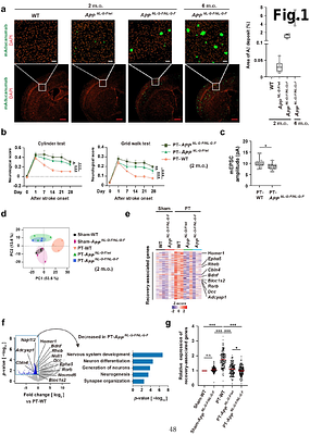 Anti-amyloid beta therapy resolves stroke recovery impairment caused by Alzheimer's disease