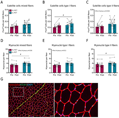 Comparable Strength and Hypertrophic Adaptations to Low-Load and High-Load Resistance Exercise Training in Trained Individuals: Many Roads Lead to Rome