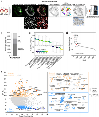 Deep Visual Proteomics links vascular smooth muscle cell phenotypes to atherosclerotic plaque stability