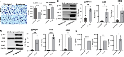 Streptococcus anginosus Activates the NLRP3 Inflammasome to Promote Inflammatory Responses from Macrophages