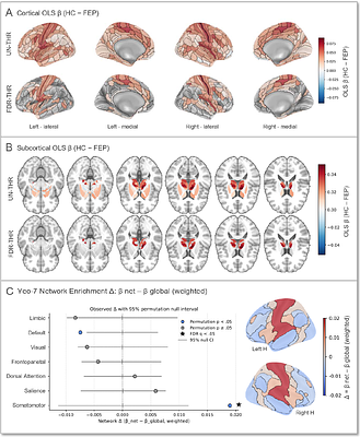 Convergent Multimodal Evidence of Cortical Excitation-Inhibition Imbalance in Psychosis