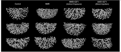 Aberrant placental structure is corrected with repeated nanoparticle-mediated IGF1 treatments in a guinea pig model of fetal growth restriction