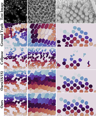 S$^3$-TTA: Scale-Style Selection for Test-Time Augmentation in
  Biomedical Image Segmentation