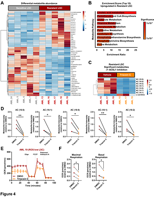 Therapy resistance in AML is mediated by cytoplasmic sequestration of the transcriptional repressor IRF2BP2