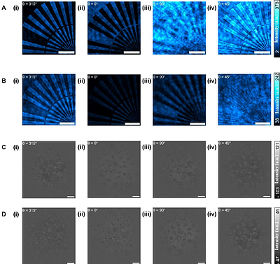 Instantaneous Phase-Shifting Optothermal Microscopy for Live-cell Metabolic Monitoring