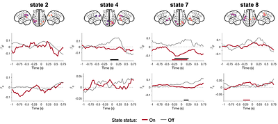 Distinct Alpha Networks Modulate Different Aspects of Perceptual Decision-Making