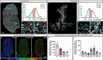Illuminating the complete β-cell mass of the human pancreas - signifying a new view on the islets of Langerhans