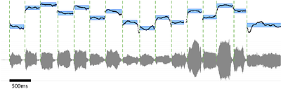 Humans, but not songbirds, produce spontaneously isochronous song through the lifespan
