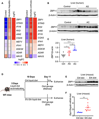The critical role of the ZBP1-NINJ1 axis and IRF1/IRF9 in ethanol-induced cell death, PANoptosis, and alcohol-associated liver disease