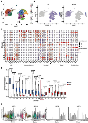 Longitudinal single-cell RNA sequencing of a neuroendocrine transdifferentiation model reveals transcriptional reprogramming in treatment-induced neuroendocrine prostate cancer