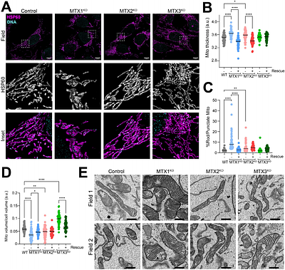 Characterization of human Metaxin proteins reveals functional diversification of SAM37 homologs MTX1 and MTX3