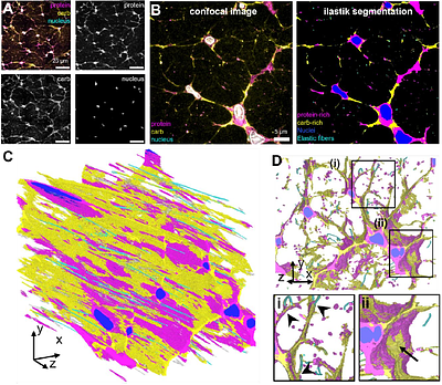 Expansion Microscopy reveals changes in cellular and extracellular structures between healthy and perturbed tendons