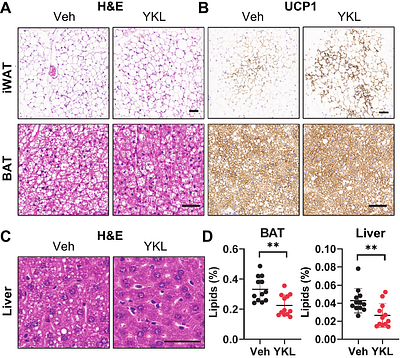 Salt-inducible kinase inhibition promotes weight loss and improves the diastolic function of obesity-related heart failure with preserved ejection fraction in mice